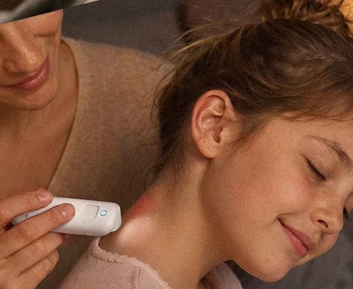 Mosquito Bite Relief Tool Deal: Save $14.80